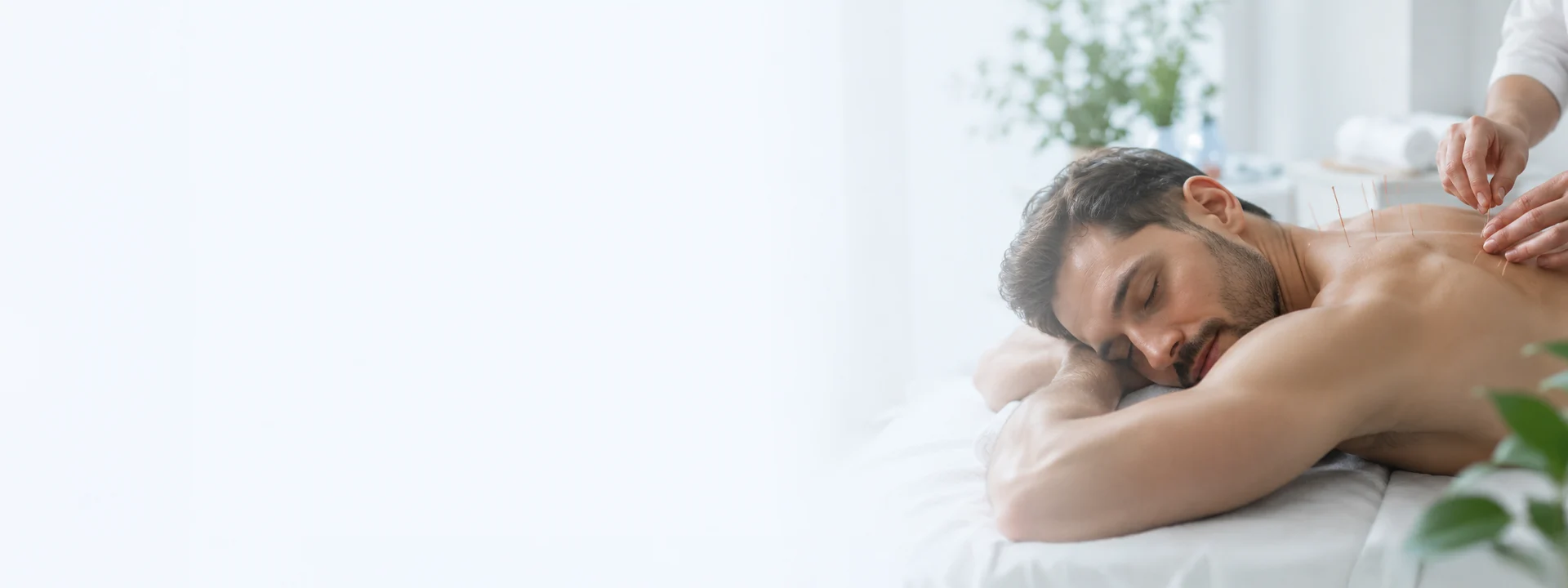 Acupuncture for pain and stress relief service guide